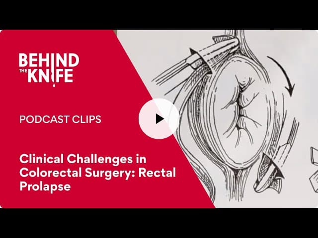 Clinical Challenges in Colorectal Surgery: Rectal Prolapse