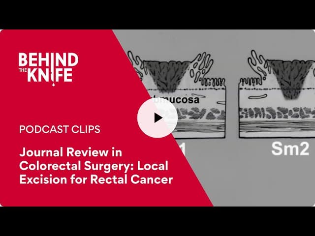 Journal Review in Colorectal Surgery Local Excision for Rectal Cancer