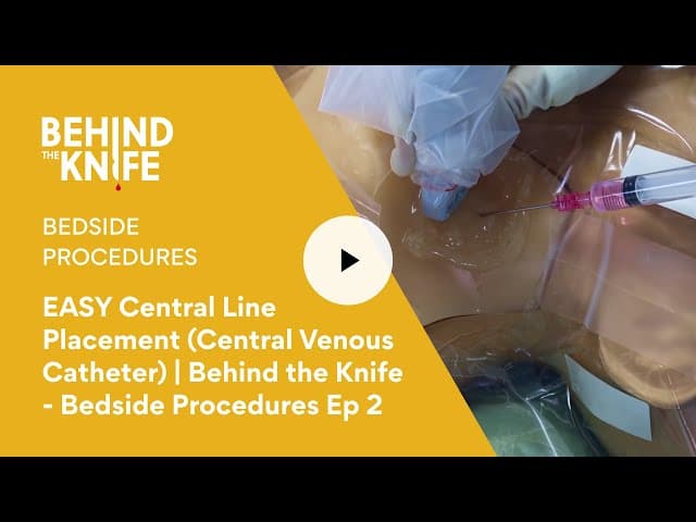 EASY Central Line Placement | (Central Venous Catheter) | Behind the Knife - Bedside Procedures Ep 2
