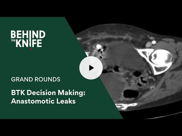BTK Decision Making: Anastomotic Leaks