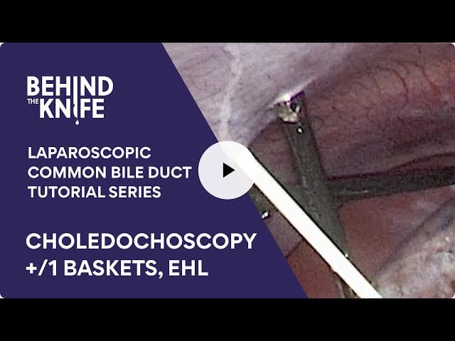 Choledochoscopy +:  Baskets:EHL | Laparoscopic Common Bile Duct Tutorial Series: Ep. 6