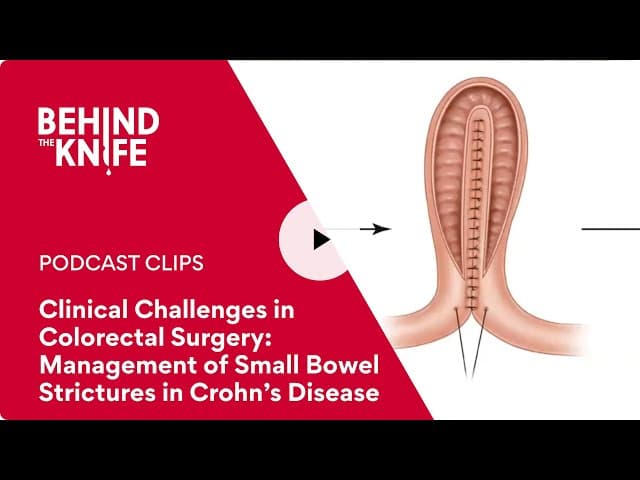 Clinical Challenges in Colorectal Surgery: Management of Small Bowel Strictures in Crohn’s Disease
