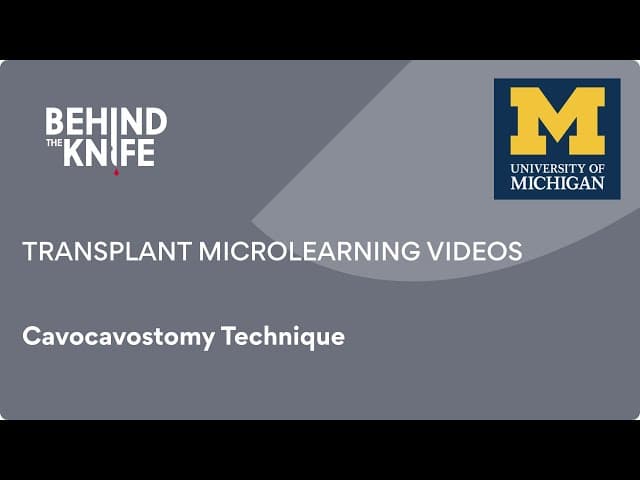 Cavocavostomy Technique