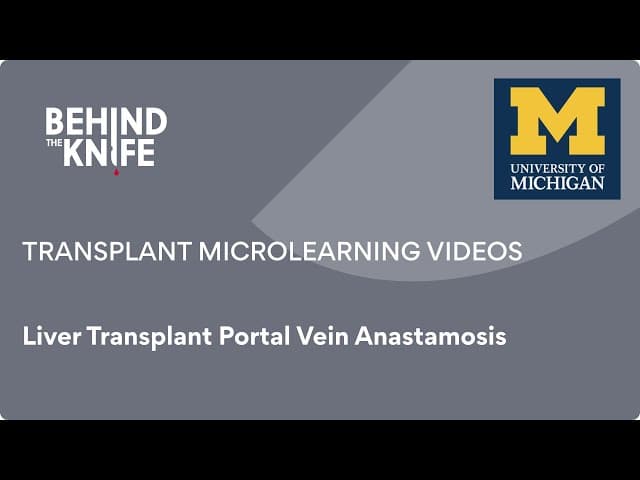 Liver Transplant Portal Vein Anastamosis