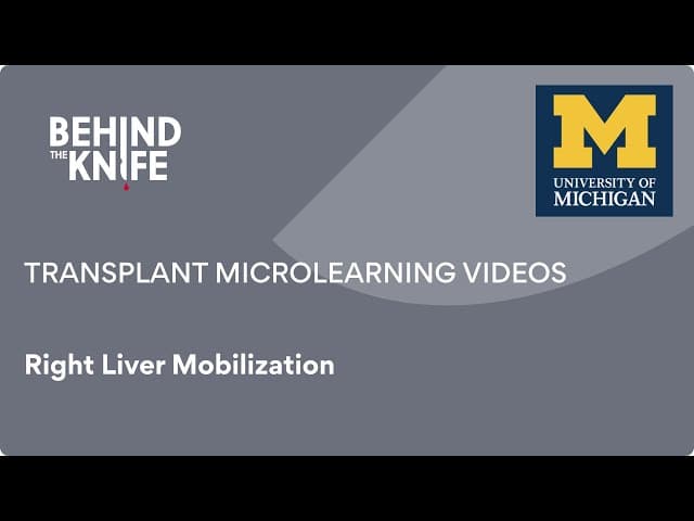 Right Liver Mobilization
