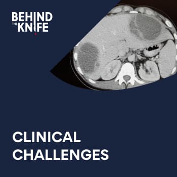 Clinical Challenges in Burn Surgery: Global Burn Surgery