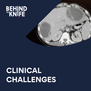 Clinical Challenges
